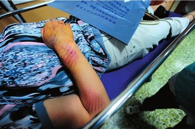 北京地鐵4號線事故，1人死亡3人重傷【圖】[1]7