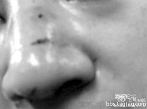兩留學生在悉尼遭暴打警方稱6暴徒被抓獲[1]1