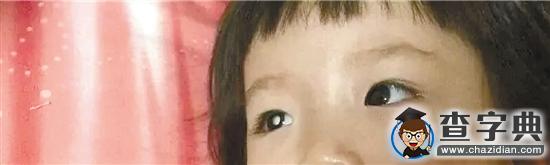 武義2歲女孩罹患眼癌 還想看看世界有多美1