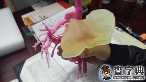 上海交大附屬院3D打印技術助力母子“拼肝”1
