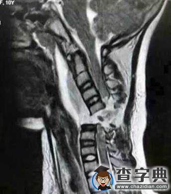 冬天這樣帶圍巾會有生命危險！2