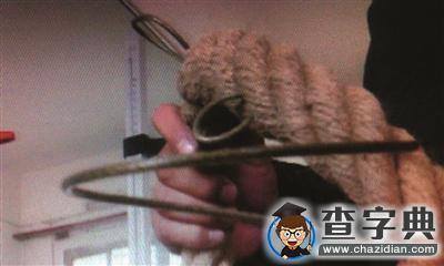 11歲女孩拔河拔斷手指？杭州醫生提醒家長注意1