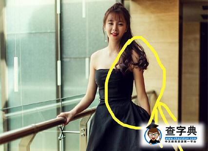 沈夢辰又P圖了！腳踝畸形似骨折(圖)2