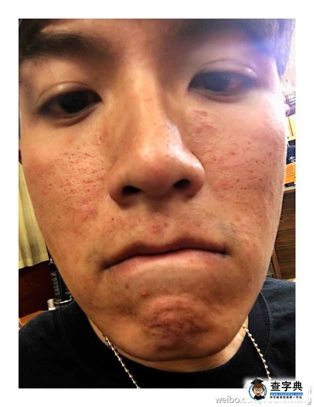 柯震東顏值全無 遭網友調侃是吸毒后遺癥1