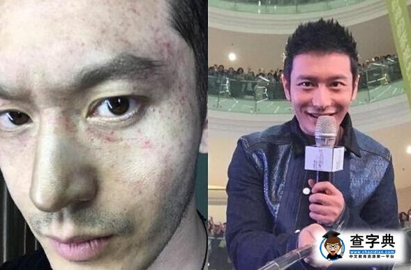 黃曉明拍戲致面部血管爆裂 網友：Baby親親就好1